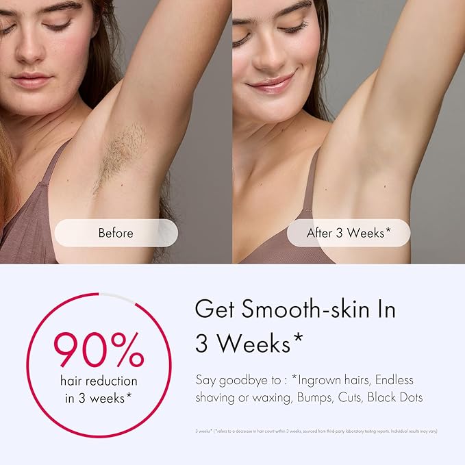 Ulike Laser Hair Removal for Women and Men, Air 3 Ice-Cooling IPL Device Hair Removal for Nearly Painless & Long-Lasting Results, 3 Modes & Auto Flashing for Fast Full Body Hair Removal from Home-BrightBean Baby