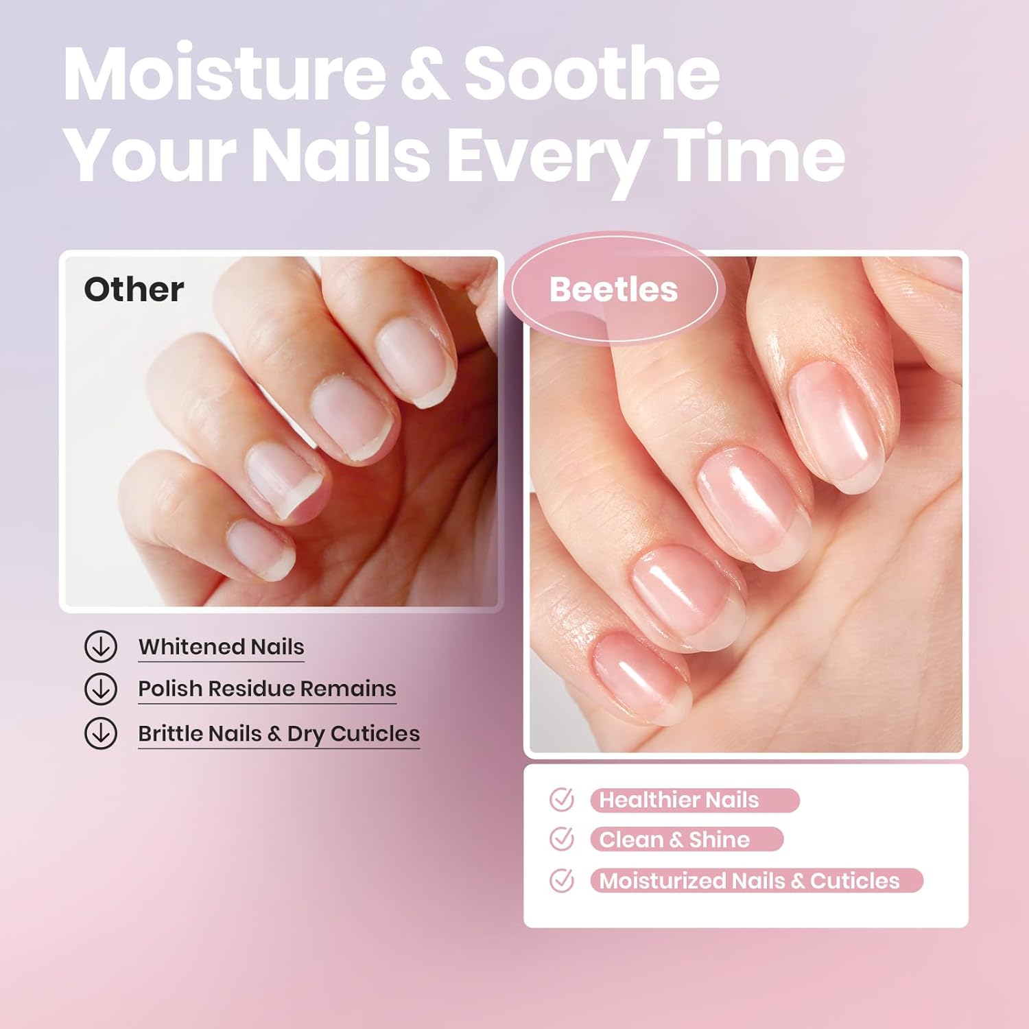 Beetles Non Acetone Nail Polish Remover - 0.67Fl Oz/20ML Nourishing Formula Acetone Free Nail Polish Remover - Non-Drying - Professional Quick and Gentle Removal for Natural Damaged Nails-BrightBean Baby