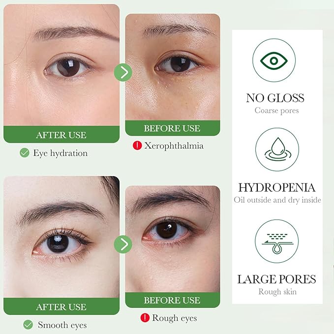 BIOAQUA Centella Asiatica Nourish Repair Eye Cream Soothing Oil Control Anti-Acne 20g / 0.7oz-BrightBean Baby