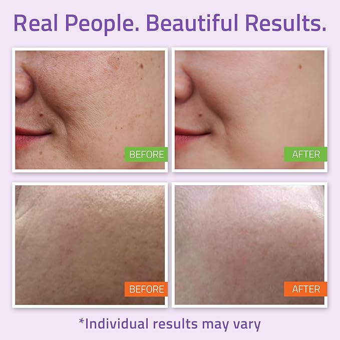 YEOUTH Skin Care Set: Hyaluronic Acid Serum for Face, Vitamin C Serum, Facial Toner, Under Eye Gel, Face Cream, Skin Care Kit for Women & Men 5-Piece-BrightBean Baby