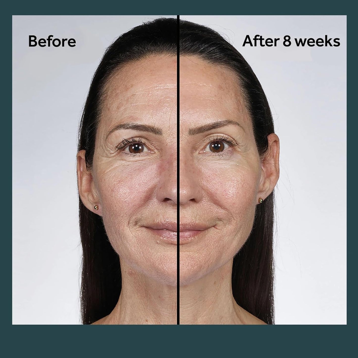 No7 Future Renew Damage Reversal Night Cream - Anti Aging Face Moisturizer - Infused with Peptide Technology to Reverse Visible Signs of Damage - Skin Barrier Repair for Dry Skin (1.69 Oz)-BrightBean Baby