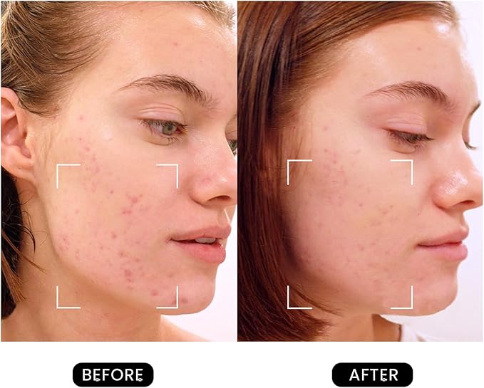 Revive Skincare for Anti-Aging, Glow Like Never Before,Multifunctional Beauty Device, Facial Massager for Home use-BrightBean Baby