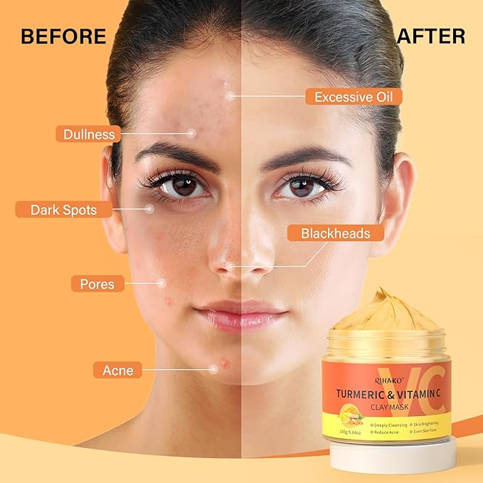 Turmeric Vitamin C Clay Mask -Turmeric Facial Mask - Brightening Clay Face Mask Skincare, Deep Cleansing Face Mask, Acne Face Mask for for Dark Spots, Dull Skin, Refining Pores and Controlling Oil-BrightBean Baby