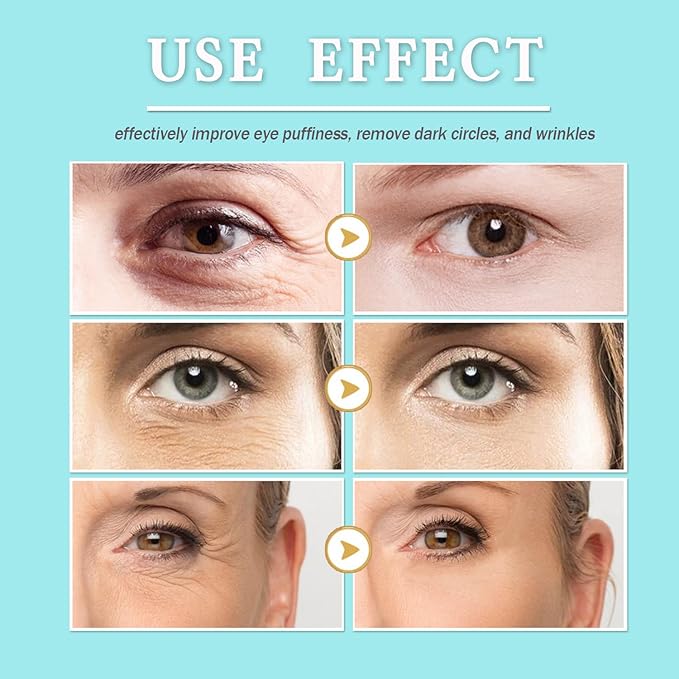 28 Pairs Collagen Eye Mask, Anti Wrinkle Eye Patches for Puffy Eyes and Dark Circles, Natural Marine Collagen Eye Gel Pads for Puffiness, Eye Treatment Skin Care for Puffiness Wrinkle Eye Bags-BrightBean Baby