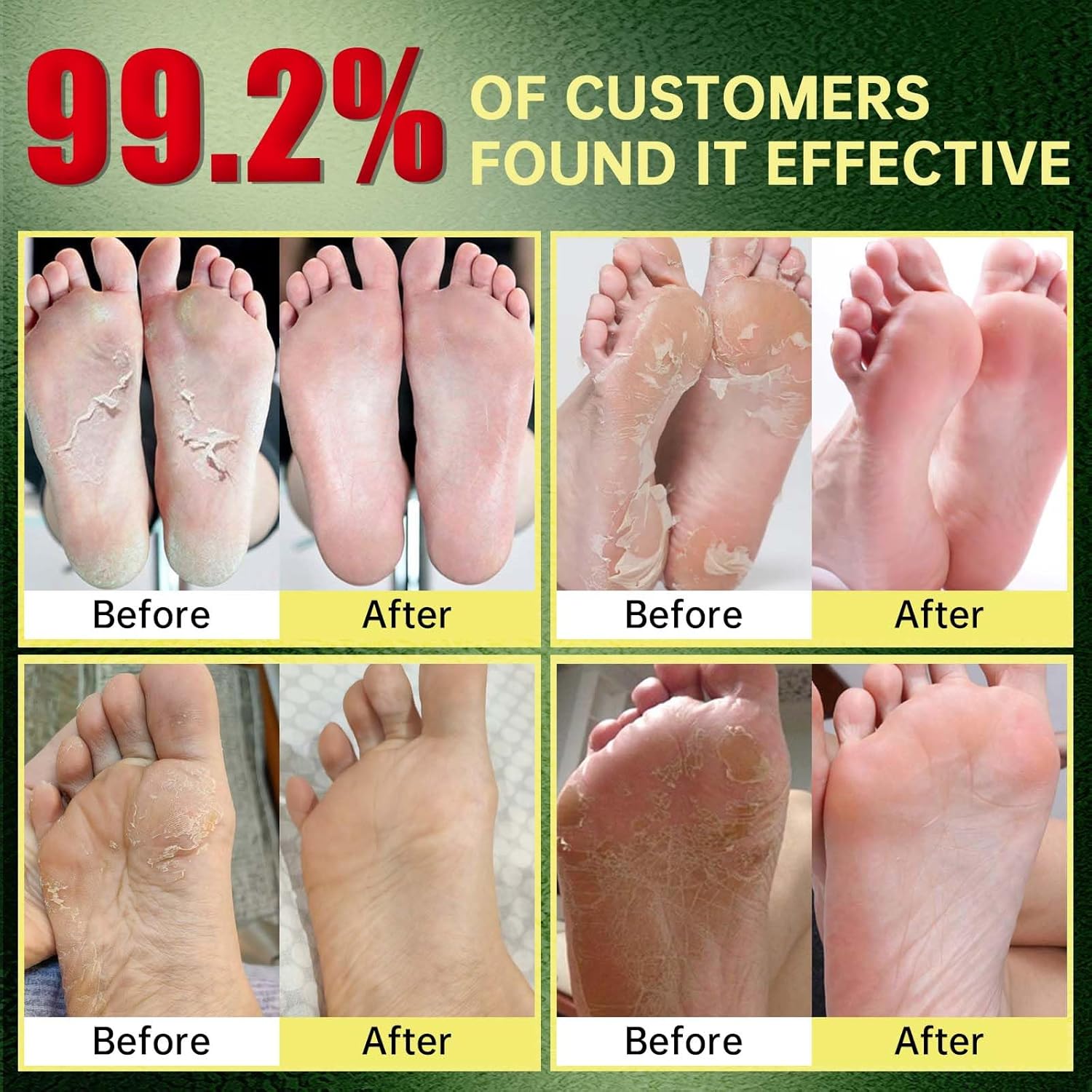 Foot Peeling Mask, Natural Exfoliating Foot Mask, Dead Skin Callus Remover Repair Heels, Hydrating Foot Care for Dry Cracked Feet（3 PacK）-BrightBean Baby