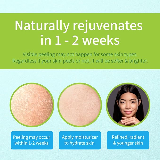 Ebanel Chemical Peel for Face, AHA BHA Exfoliator, Glycolic Acid Peel, Salicylic & Lactic Acid Face Peeling Gel, Infused with Green Tea & Chamomile for Acne Scars, Dark Spots, Wrinkles, Fine Lines-BrightBean Baby