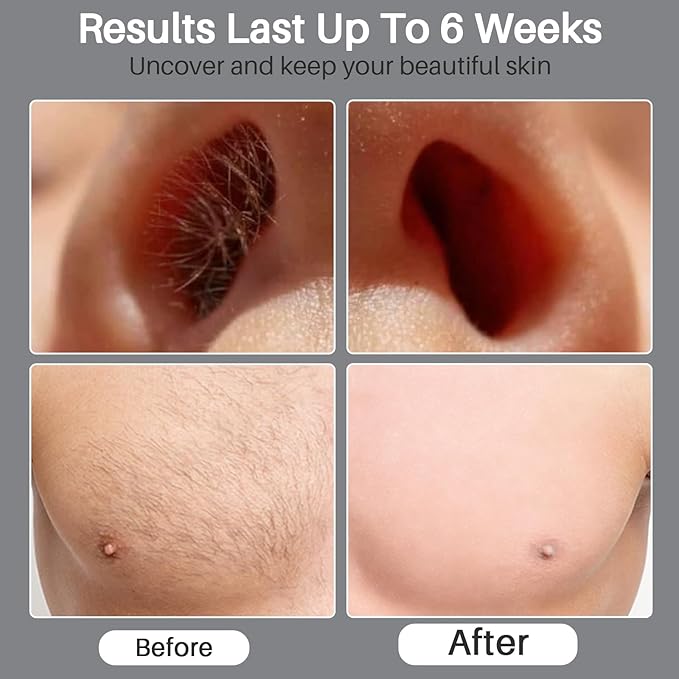 BLITZWAX Back and Nose Waxing Kit for Men, Hard Wax Warmer for Brazilian, Body and Face, At Home Hair Removal Kit, Beginner Friendly, Quick Heating, 93 Accessories, Charcoal Grey-BrightBean Baby