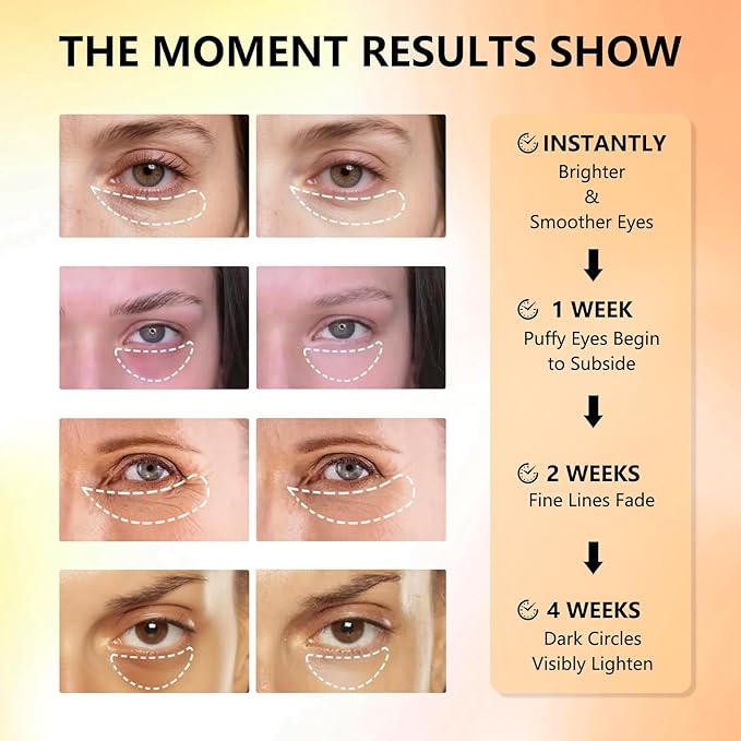 Under Eye Patches with Vitamin C & Caffeine 30 Pairs for Dark Circles, Fine Lines and Puffiness, with Niacinamide Hydra-Gel Collagen, Skin Care for Men & Women-BrightBean Baby