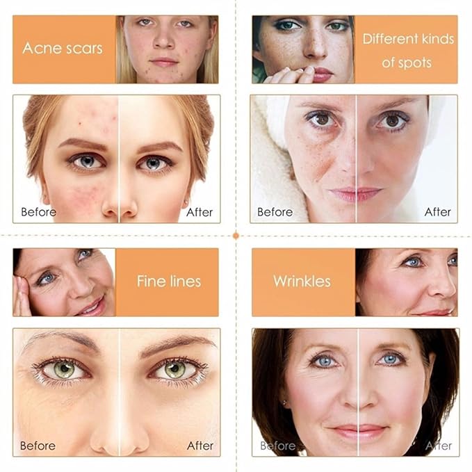 Skin Care Set ,Vitamin C Facial Serum Care Set ,Skin Care Routine Kit -Cleanser, Face Serum, Face Cream,Toner, Eye Cream,Anti- Aging Skin Care Sets & Kits,Women Gift Sets (SetD)-BrightBean Baby