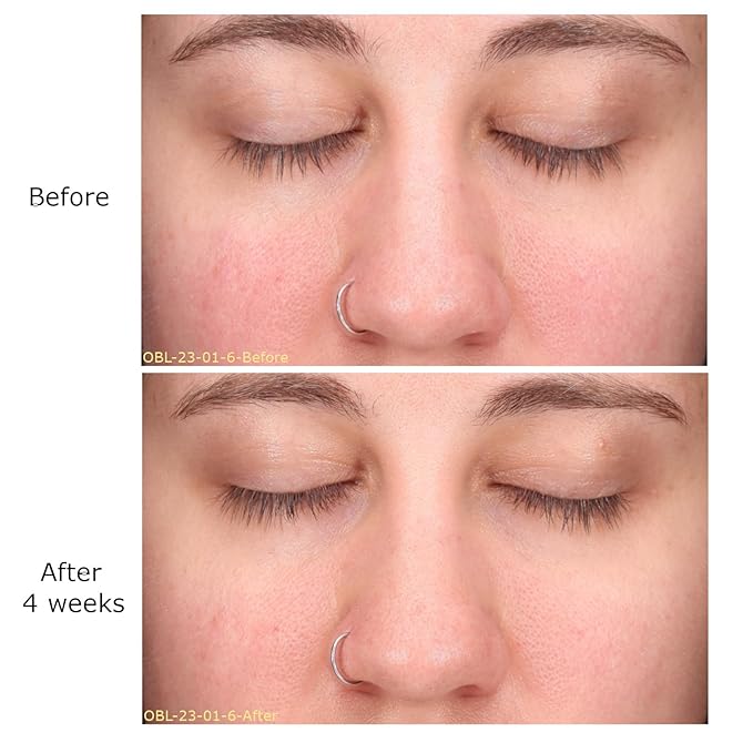 Daily Moisturizing Collection, Activator with Clarifying Azelaic Acid+ Concentrate Starter, Brightening, Firming Clarity, Suitable for Sensitive Skin, Gift Bundle/Starter Kit-BrightBean Baby