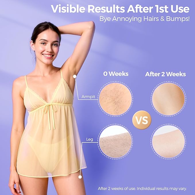 Laser Hair Removal with 5℃ Ice Cooling, Painless IPL Laser Hair Removal Device for Women & Men, 999,999 Flashes, 5 Levels, 2 Modes, Permanent At-Home Hair Removal for Face & Body, with 3 in 1 Set-BrightBean Baby