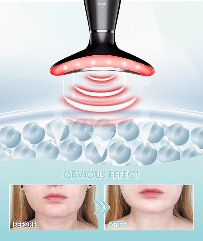 7 Color Neck Face Massager - Facial Massager Tool for Skin Care at Home, Vibrating Face Massager with Thermals, Galvanic Machines Black-BrightBean Baby