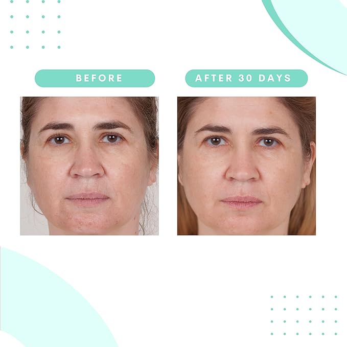 Serious Skincare Glycolic Skin Renewal Set - Retexturizing Serum - Facial Moisture Cream - Face Wash Cleanser - Balancing Blue Tansy Extract - Improve Appearance of Lines, Wrinkles and Enlarged Pores-BrightBean Baby