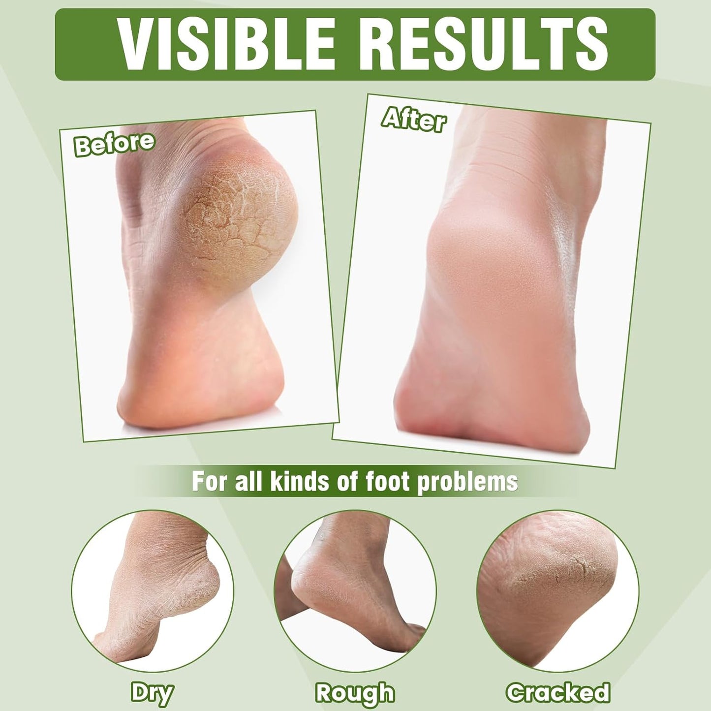 6 Pairs Moisturizing Foot Masks with Shea Butter, Jojoba Oil, Vitamin E & Urea, 6 Pairs Intensely Hydrating Foot Mask For Dry Cracked Feet, Moisturizing Socks for Cracked Heel Treatment-BrightBean Baby