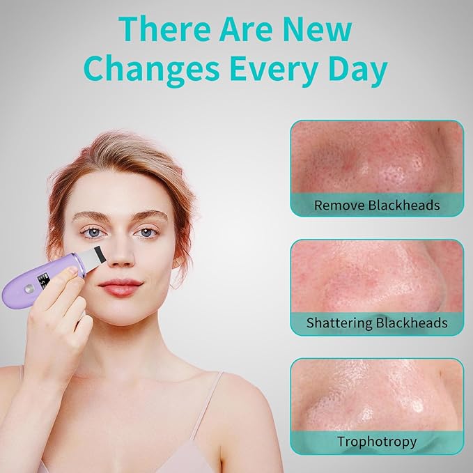 Skin Scrubber Facial Spatula - 4-in-1 Deep Cleansing Tool for Pore Extraction, Fast Charging Dock Blackhead Remover Face Spatula for Facial Skincare Women Gift (Purple)-BrightBean Baby