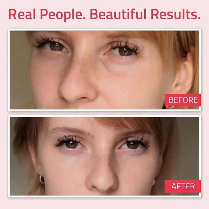 YEOUTH Retinol Eye Cream with Hyaluronic Acid, Hydrating Under Eye Cream for a Refreshed Appearance, Retinol Cream for Face, Eye Care 2oz-BrightBean Baby