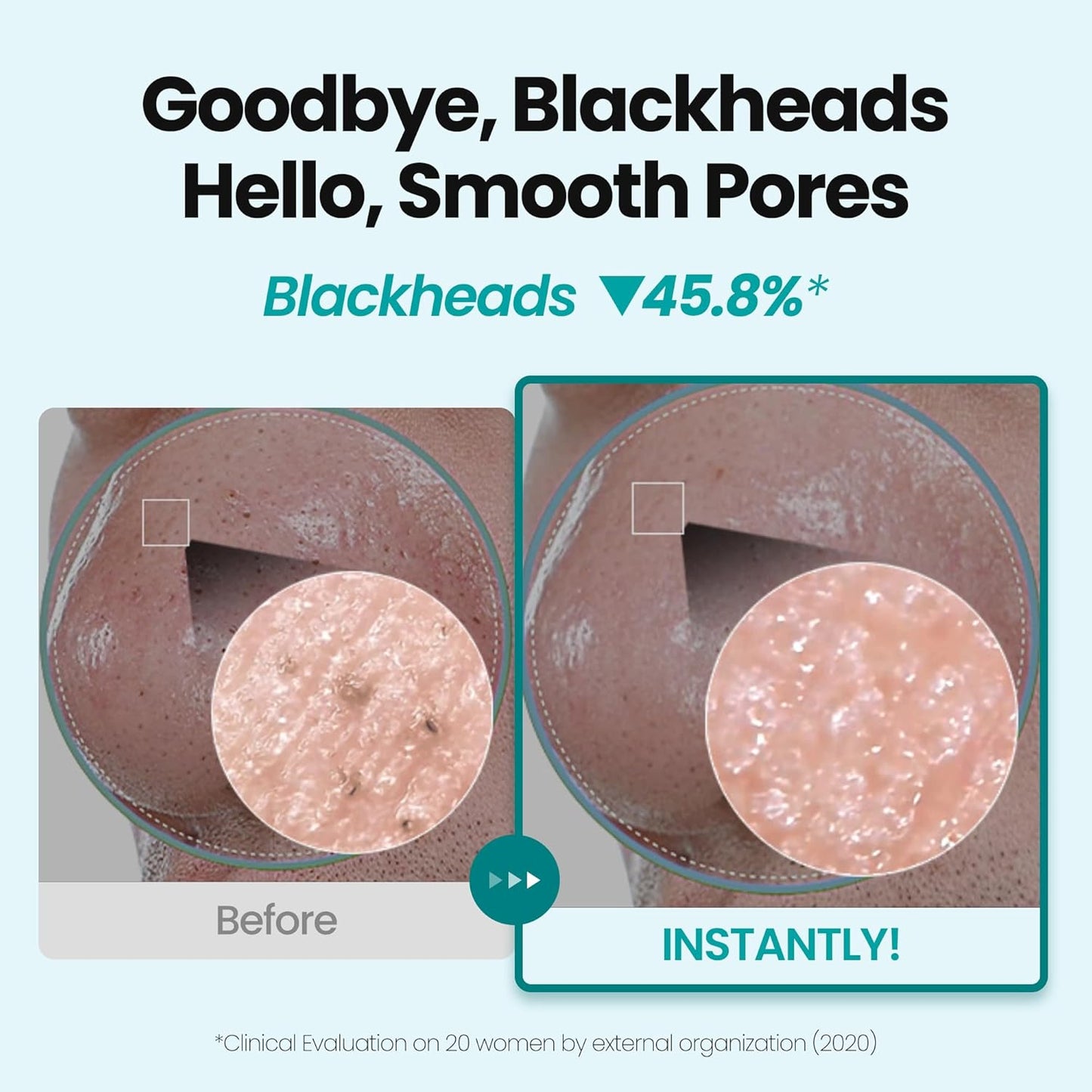 [K-Beauty] Blue Tansy Oil to Foam - All-in-One Korean Face Wash OilBased Foaming Facial Cleanser - Excess Sebum & Oil Control - Makeup Deep Cleansing Oil for All Skin Types (3.88 fl oz)-BrightBean Baby