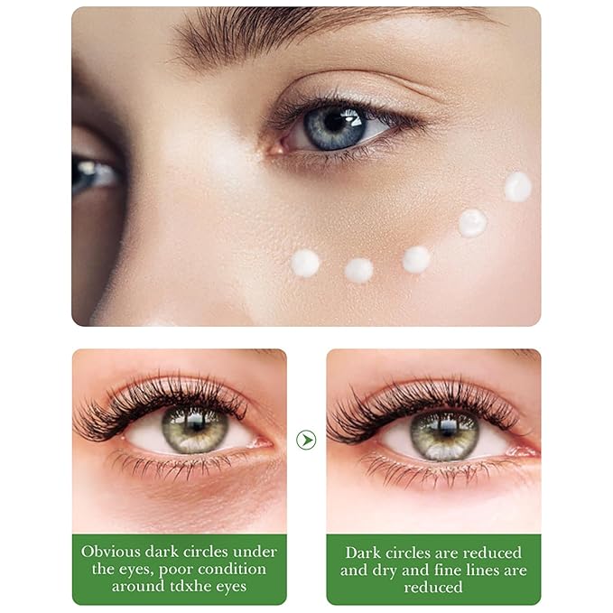 BIOAQUA Centella Asiatica Nourish Repair Eye Cream Soothing Oil Control Anti-Acne 20g / 0.7oz-BrightBean Baby