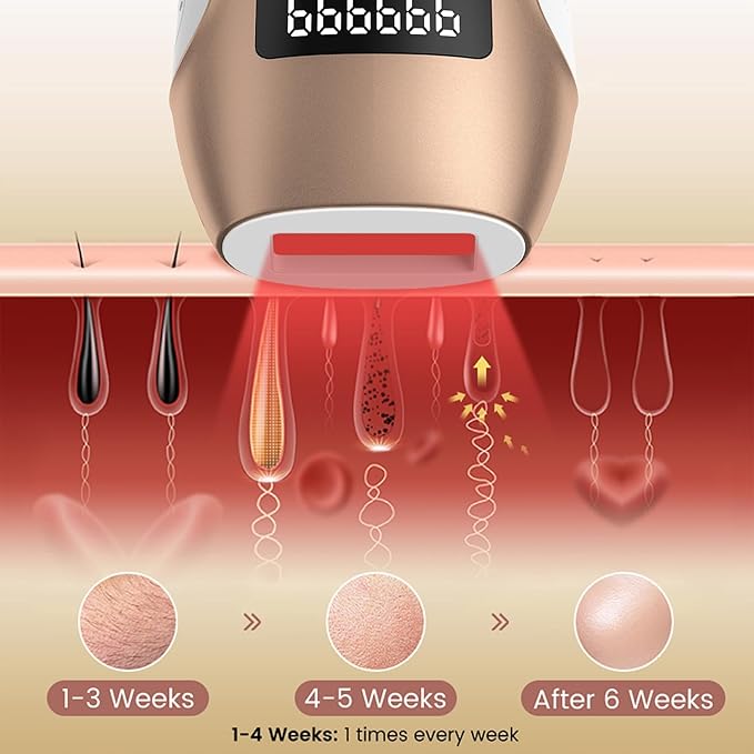 Hair Removal Device, Hair Removal for Women and Men，Hair Removal Body and Face for Home Use,model S3-BrightBean Baby