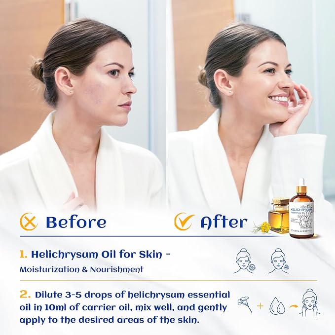 HIQILI Helichrysum Essential Oil for Skin Nourish, Undiluted & Natural, Relieve Fatigue in Body Massage, Reduce Fine Line and Wrinkle, Aromatherapy Diffuser, DIY Floral Scented Gift -100ML-BrightBean Baby