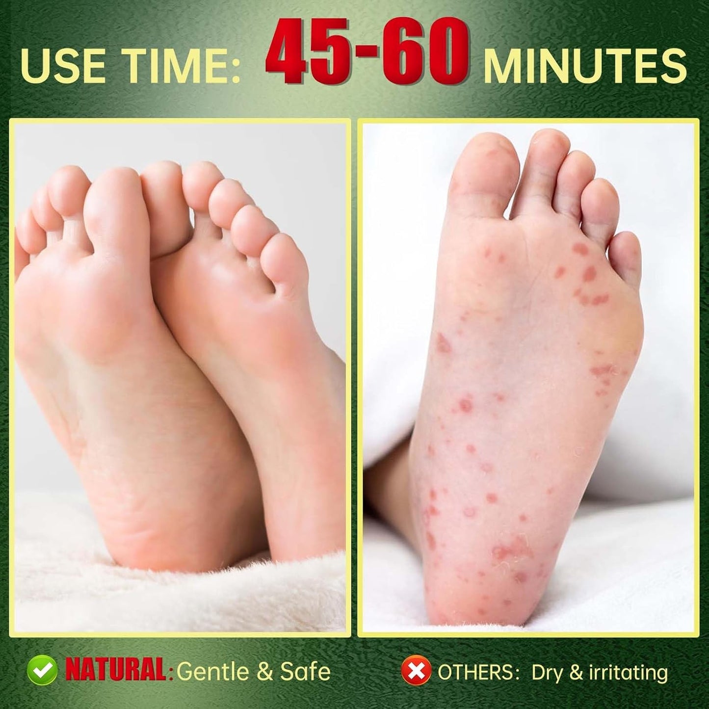 Foot Peeling Mask, Natural Exfoliating Foot Mask, Dead Skin Callus Remover Repair Heels, Hydrating Foot Care for Dry Cracked Feet（3 PacK）-BrightBean Baby