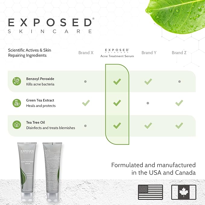 Exposed Skin Care Acne Treatment Serum Step 3 – Quickly Reduces Pimple Size and Redness - 12 Hour Spot Treatment - 3.5% Benzoyl Peroxide, Natural Green Tea & Tea Tree Oil-BrightBean Baby