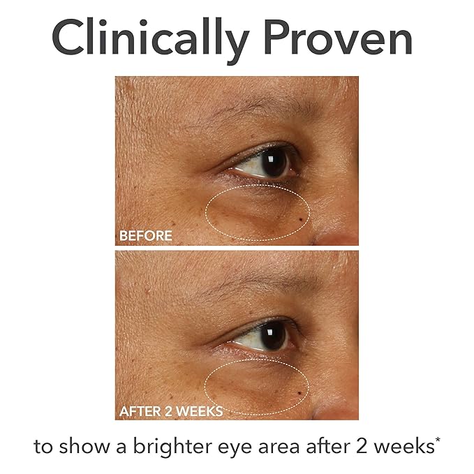 Dr Dennis Gross DermInfusions Fill + Repair Eye Cream: Hydrating & Brightening Treatment for Dark Circles, Fine Lines & Wrinkles, Firms & Smooths 360° Eye Area, 0.5 Oz-BrightBean Baby