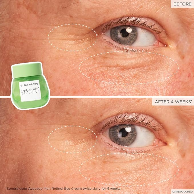 Glow Recipe Avocado Retinol Eye Cream for Wrinkles - Overnight Under Eye Cream for Dark Circles, Firming & Brightening Dull, Puffy Eyes - Time Release Niacinamide & Caffeine Eye Cream (15ml)-BrightBean Baby