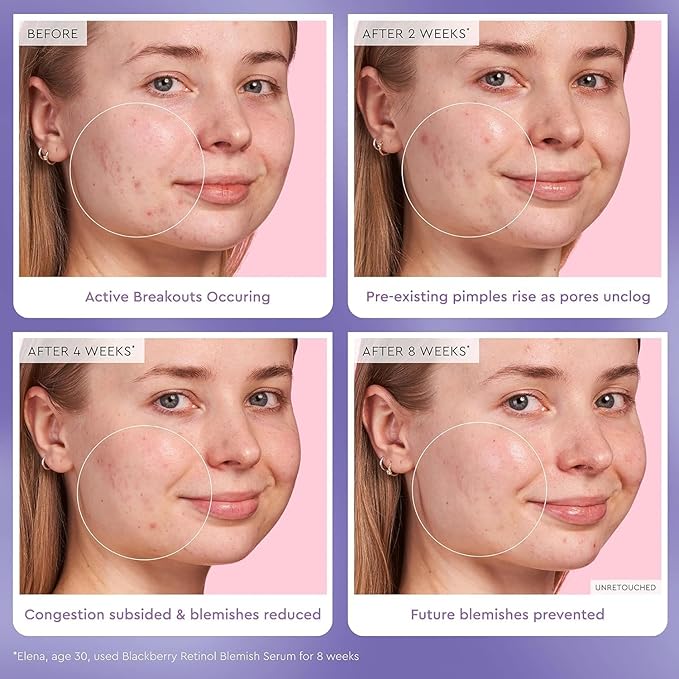 Glow Recipe Glass Skin Hydration Travel Size Korean Skincare Set - Includes Mini Cloudberry Facial Toner, Strawberry Blur Drops, Blackberry Retinol Serum & Pink Juice Moisturizer (4 Count)-BrightBean Baby