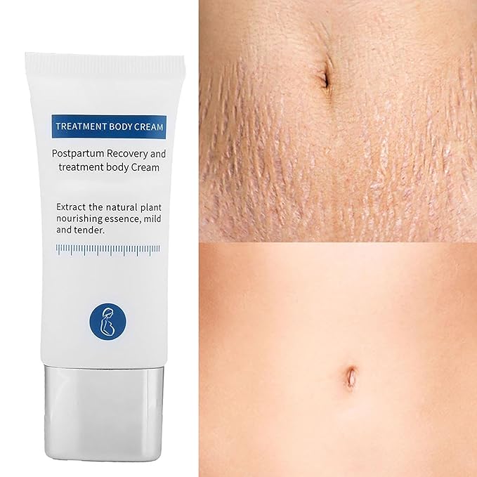 Generic Stretch Marks Removal Cream, Reduce Old Marks, Restore Elasticity, Firm & Lift Skin, Safe & Ingredients, 30g, Compact Size-BrightBean Baby
