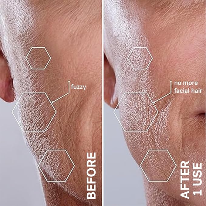 Michael Todd Beauty Sonicsmooth Dermaplane Razor for Women Face + Eyebrow trimmer Dermaplaning System - Peach Fuzz Remover - 8 Weeks of Dermaplaning Blades-BrightBean Baby