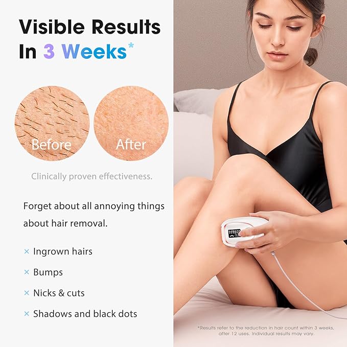 IPL Laser Hair Removal Device for Women & Men - Home 45°F Ice-Cooling Contact for Painless & Long-Lasting Results, 86% Hair Reduction in 3 Weeks for Full Body & Bikini Line, White-BrightBean Baby