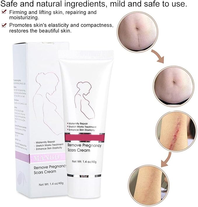 RtopR Stretch Marks and Scar Cream,Crema para Estrias De Embarazo,Stretch Marks Postpartum Repairing Cream Wrinkles Diluting Removal Cream Crema De Cacao para Cicatrices-BrightBean Baby