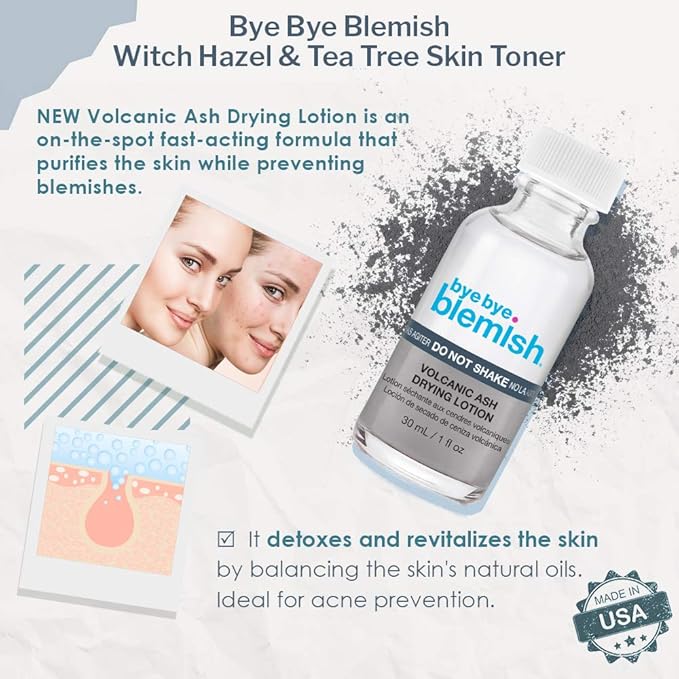 Bye Bye Blemish Drying Lotion Volcanic Ash | Acne Drying Solution To Assist With Blemish Prevention | 1 Fl. Oz.-BrightBean Baby