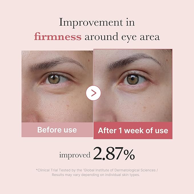 medicube Salmon DNA PDRN Pink Peptide Eye Serum with Niacinamide and 99% Purity Retinol for Fine Lines, Uneven Skin Tone, Korean Skin Care 1.01fl.oz-BrightBean Baby