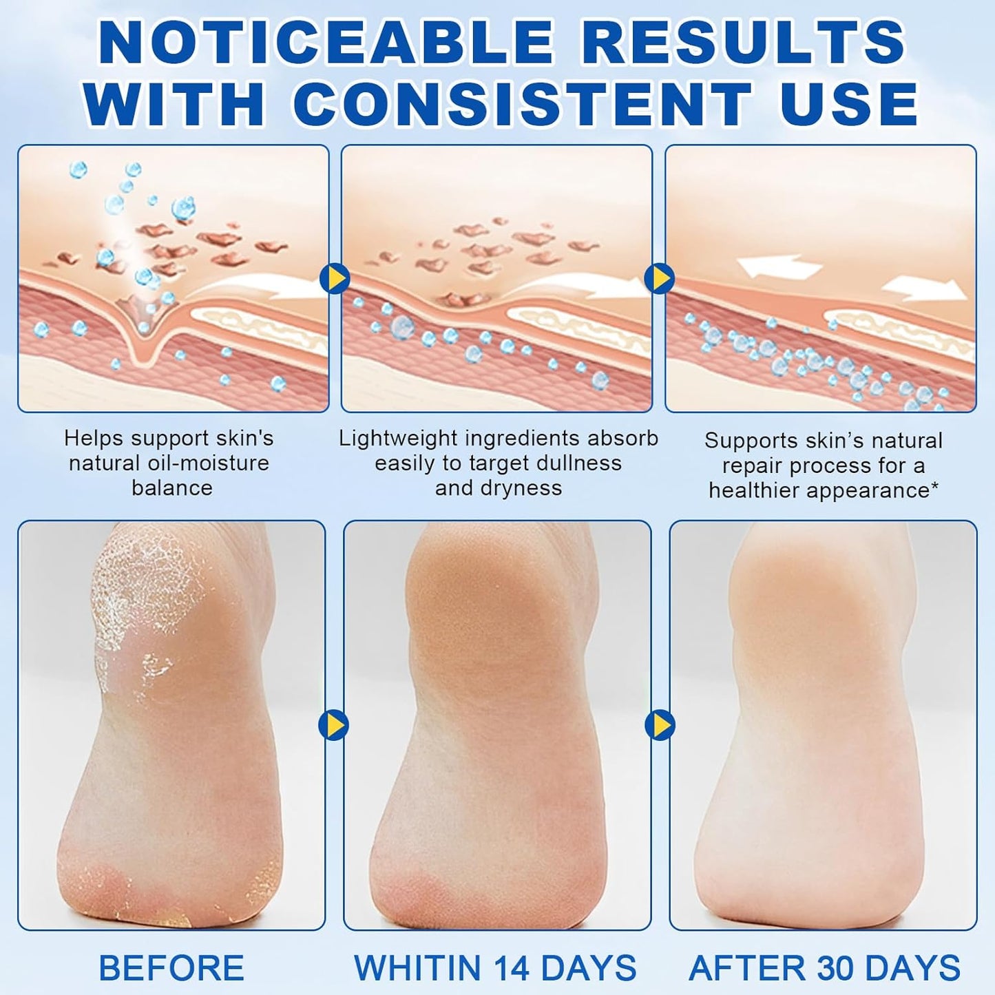 2Pack 60% Urea with 2% Salicylic Acid Urea Foot Care Stick, Foot Cream Moisturizer for Dry Cracked Feet, Knees, Elbows, Hands,Moisturizes and Hydrates the Dry Skin,Callus Remover & Skin Softener-BrightBean Baby