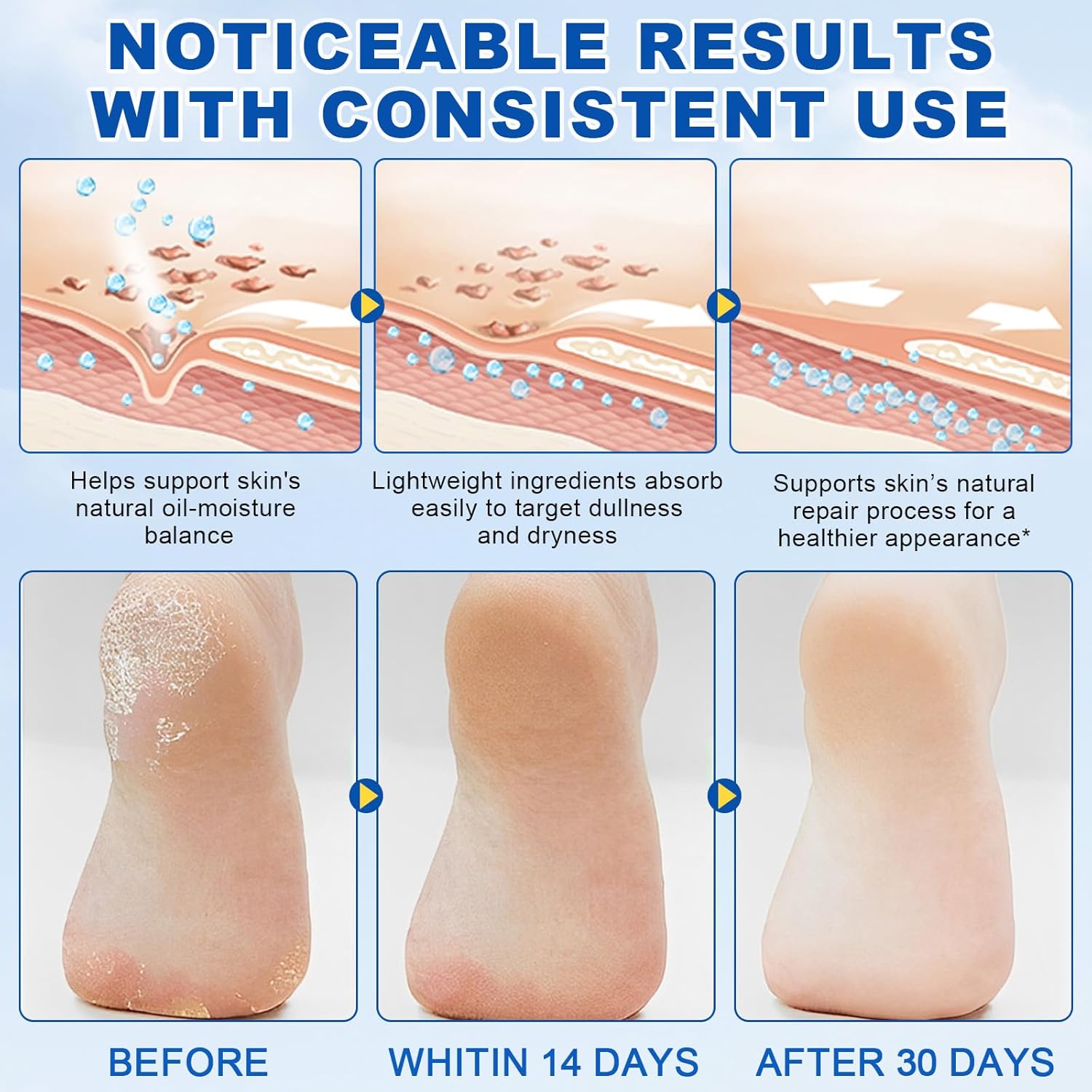 2Pack 60% Urea with 2% Salicylic Acid Urea Foot Care Stick, Foot Cream Moisturizer for Dry Cracked Feet, Knees, Elbows, Hands,Moisturizes and Hydrates the Dry Skin,Callus Remover & Skin Softener-BrightBean Baby