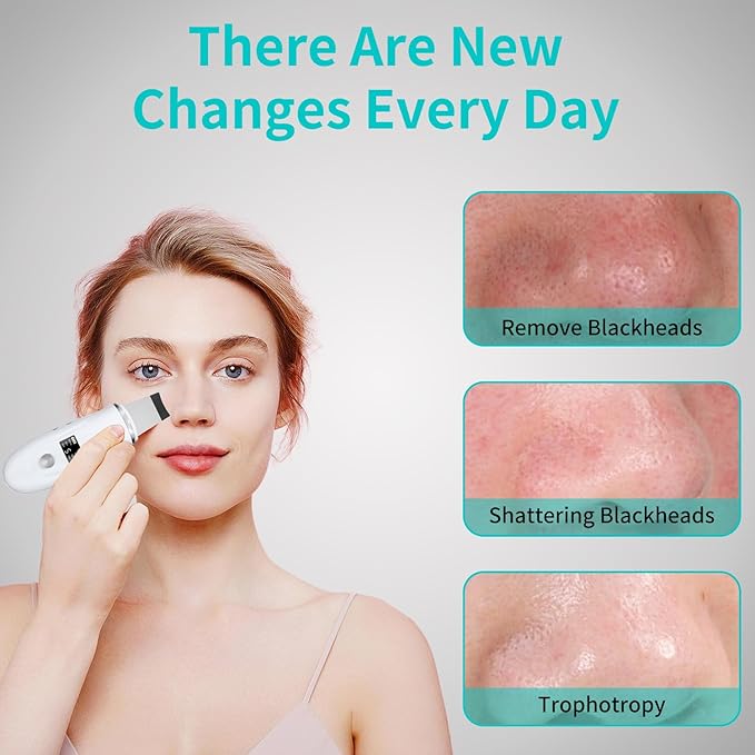 Skin Scrubber Face Spatula - 4-in-1 Deep Cleansing Tool for Pore Extraction, Fast Charging Dock Blackhead Remover Face Spatula for Facial Skincare Women Gift (White)-BrightBean Baby