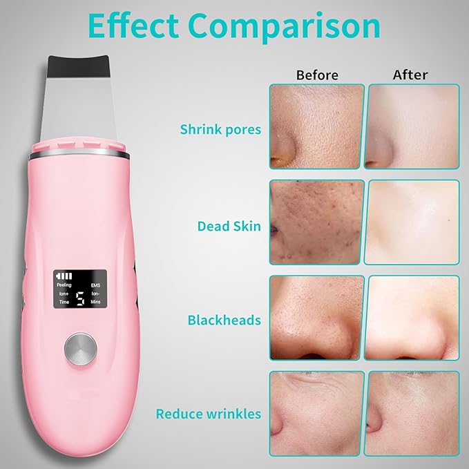 Skin Scrubber Facial Spatula - 4-in-1 Deep Cleansing Tool for Pore Extraction, Fast Charging Dock Blackhead Remover Face Spatula for Facial Skincare Women Gift (Pink)-BrightBean Baby