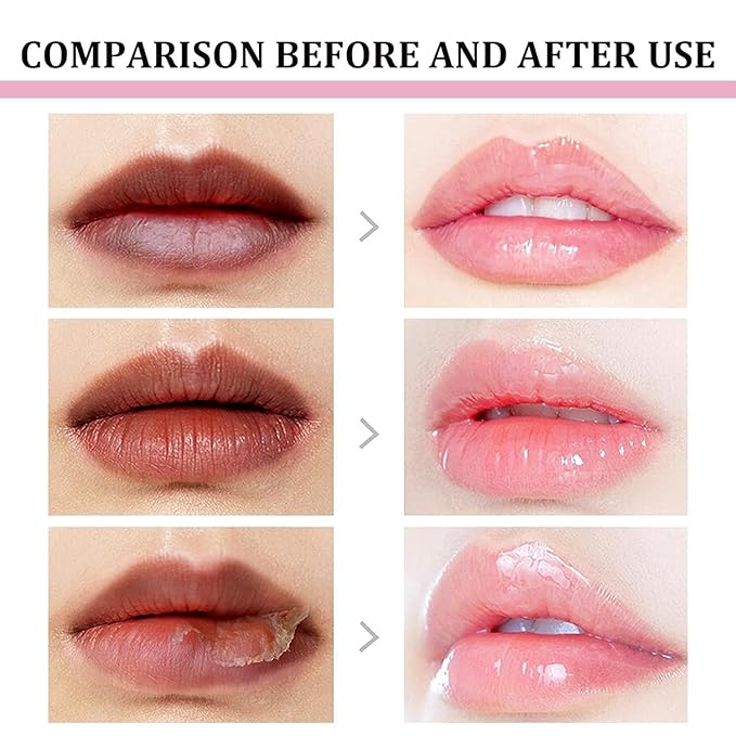 2pcs Lip Lightening for Dark Lips Lip Brightener for Smokers Dark Lip Treatment Lightening Cream for Pink Lips Lip Lightener for Smoker Lips Lip Lightening balm for Men and Women (Red)-BrightBean Baby