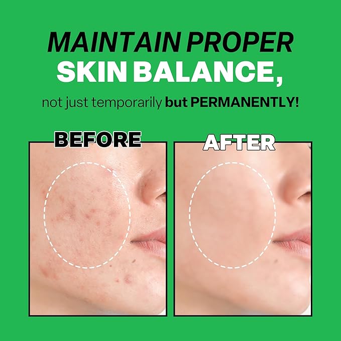 Troubless Mild Clear Toner Essence - Tea Tree Facial Toner for All Skin Types | Hydrating Skin Toner, Daily Skin Care (6.76 fl oz)-BrightBean Baby