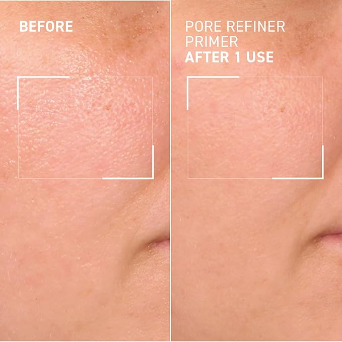 Dr. Brandt Pores No More, Pore Refiner Primer - Instantly Minimizes the Appearance of Pores, Absorbs Oil & Mattifies Shine - 1.0 fl oz-BrightBean Baby