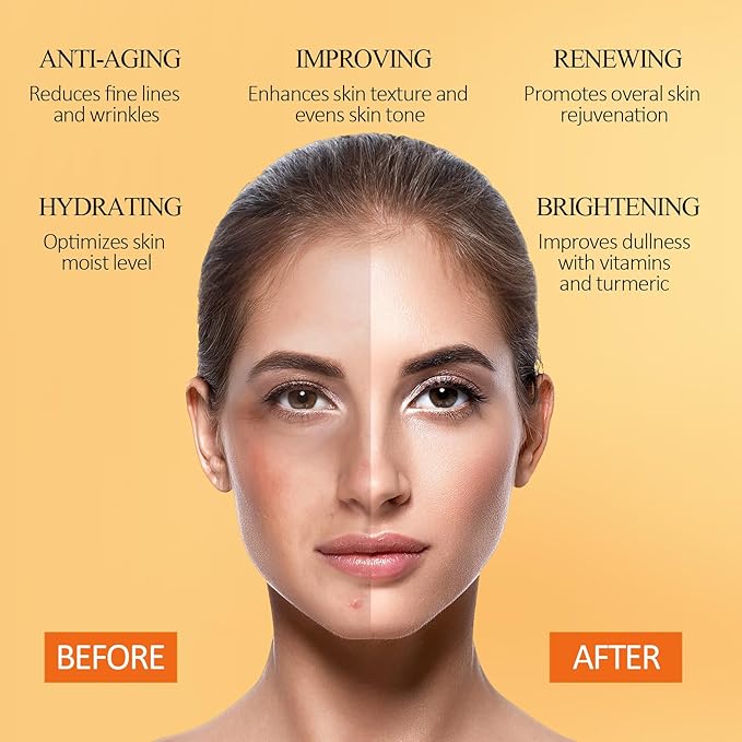 Vitamin C Face Mask with Kaolin Clay and Turmeric for Dark Spots, Dull Skin, Skincare Facial Mask for Controlling Oil and Refining Pores 5.29 Oz-BrightBean Baby