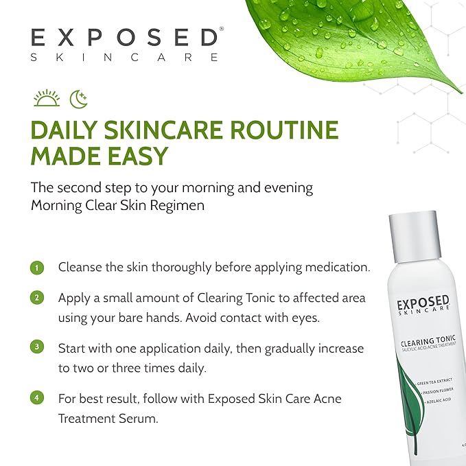 Exposed Skin Care Clearing Tonic Facial Toner with 1% Salicylic Acid and Witch Hazel for Acne Treatment – Pore Minimizing Toner to Prevent Breakouts, Reduce Redness and Balance Skin – Step 2 (4 fl oz)-BrightBean Baby