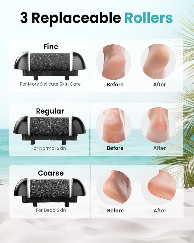 Electric Foot Callus Remover with 10000 RPM Motor and 3-Speed Settings, Foot File Kit with LED Light and Display for Women’s Home Pedicure, Waterproof Foot Grinder with Type-C Charging-BrightBean Baby