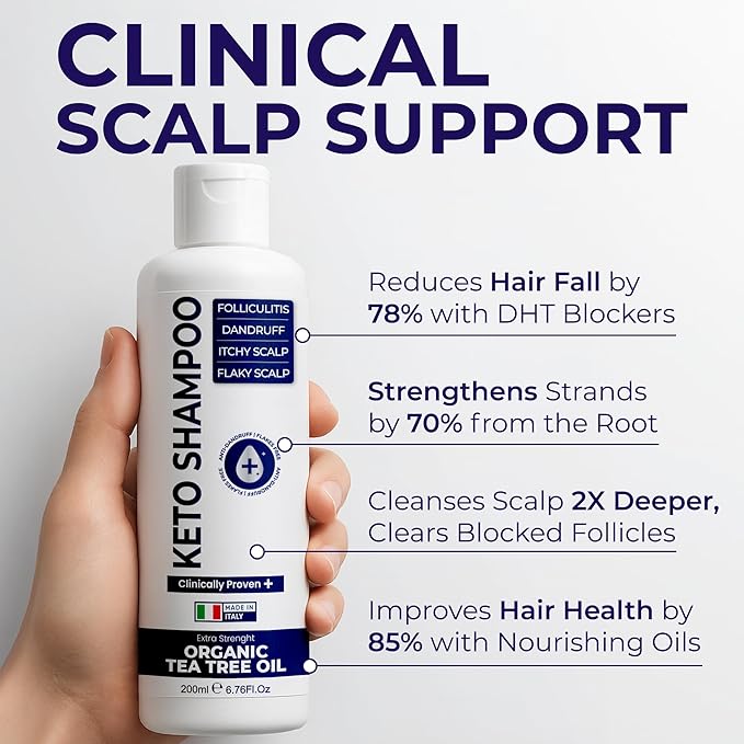 Scalp Psoriasis Shampoo, Flakes Shampoo Anti Dandruff, Itchy Scalp Treatment for Seborrheic Dermatitis & Folliculitis, Anti Fungal, Medicated Solution for Itchy, Flaky & Dry Hairs-BrightBean Baby