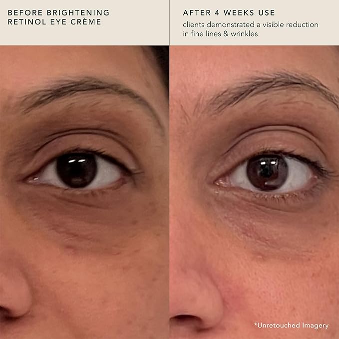 RANAVAT Brightening Retinol Eye Cream - Anti Aging Eye Cream and Dark Circle Corrector to Help Target Fine Lines - Enriched with Micro-Encapsulated Retinol, Bakuchi Seed, & Saffron (0.5 oz)-BrightBean Baby