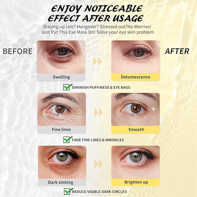 Under Eye Patches (30 Pairs), Hyaluronic Acid Eye Masks for Dark Circles Puffy Eyes Undereye Bags, Collagen Eye Patches for Wrinkles and Hydrate, Skin Care Gift for Her-BrightBean Baby