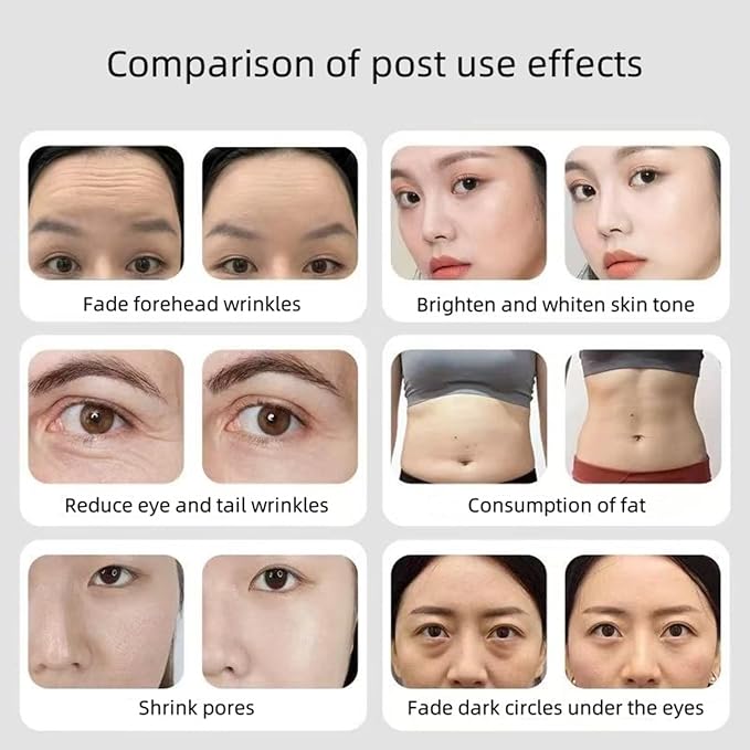 Comfortable Home Beauty Instrument, Deep Firming Technology, Strong Skin Firming, Remove Black Spots and Whiten Skin to Keep Young-BrightBean Baby