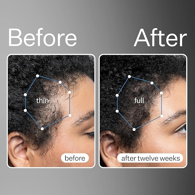 Act+Acre 3-Pack Mini Cold Processed Stem Cell Scalp Serum - Promotes Thicker, Fuller-Looking Hair - Soothes and Hydrates - Sulphate and Paraben Free - Aloe Vera for Improved Scalp Health-BrightBean Baby